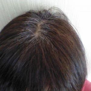 目立ち始めた白髪、諦めないで! 根本的に「改善」を目指す方法
