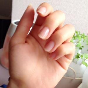 怖すぎる......放置しておくと爪がボロボロ、剥がれちゃう「グリーンネイル」知ってる?